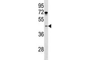 Image no. 1 for anti-ISL LIM Homeobox 1 (ISL1) (AA 156-185) antibody (ABIN3031505)