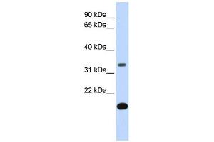 Image no. 1 for anti-Follistatin (FST) (Middle Region) antibody (ABIN634005)