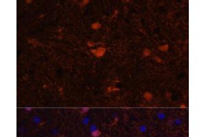 Immunofluorescence analysis of Rat brain using S100B Polyclonal Antibody at dilution of 1:100.
