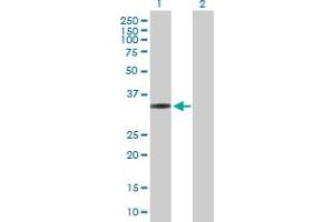 Image no. 1 for anti-Mitochondrial Ribosomal Protein L1 (MRPL1) (AA 1-303) antibody (ABIN528765)