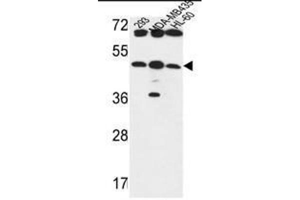 anti-UDP-GlcNAc:betaGal beta-1,3-N-Acetylglucosaminyltransferase 5 (B3GNT5) (AA 124-154), (Middle Region) antibody