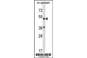 Western Blotting (WB) image for anti-Abhydrolase Domain Containing 3 (ABHD3) (C-Term) antibody (ABIN2158850)
