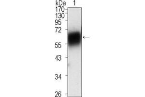 Image no. 2 for anti-Receptor Tyrosine Kinase-Like Orphan Receptor 1 (ROR1) (AA 30-406) antibody (ABIN969385)