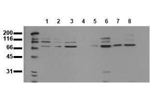 Image no. 1 for anti-Ankyrin Repeat Domain 6 (ANKRD6) antibody (ABIN126755)