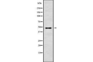 anti-Ras-Related GTP Binding D (RRAGD) (Internal Region) antibody