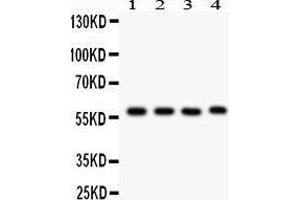 Image no. 3 for anti-Cytochrome P450, Family 1, Subfamily A, Polypeptide 1 (CYP1A1) (AA 183-320) antibody (ABIN3043819)