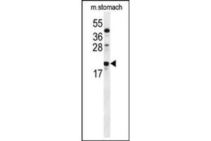 Image no. 2 for anti-S100 Calcium Binding Protein Z (S100Z) (AA 6-36), (N-Term) antibody (ABIN954659)