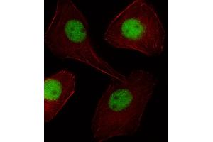 Image no. 1 for anti-Peptidoglycan Recognition Protein 1 (PGLYRP1) (AA 816-843), (C-Term) antibody (ABIN5531828)