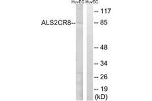 anti-Calcium Responsive Transcription Factor (CARF) (AA 311-360) antibody