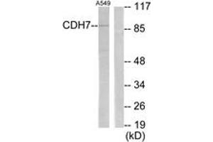 Image no. 1 for anti-Cadherin 7 (CDH7) (AA 651-700) antibody (ABIN1534297)