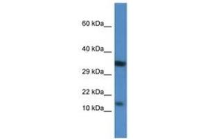 Image no. 1 for anti-Protein Kinase (CAMP-Dependent, Catalytic) Inhibitor beta (PKIB) (AA 40-89) antibody (ABIN6746525)