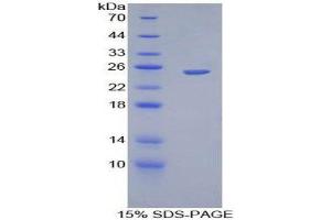 Image no. 1 for Chromogranin B (Secretogranin 1) (CHGB) (AA 496-669) protein (His tag,GST tag) (ABIN1879868)