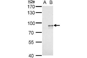 WB Image Alkyl-DHAP synthase antibody detects Alkyl-DHAP synthase protein by western blot analysis.