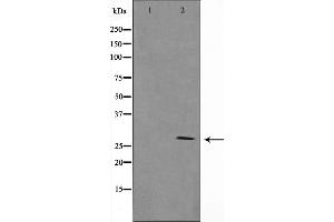 Image no. 2 for anti-Granzyme B (GZMB) antibody (ABIN6262072)
