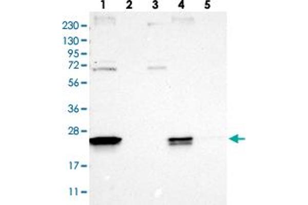 anti-Family with Sequence Similarity 213, Member A (FAM213A) antibody