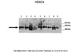 Image no. 1 for anti-Histone Deacetylase 4 (HDAC4) (C-Term) antibody (ABIN2781487)
