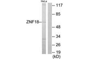 Image no. 1 for anti-Zinc Finger Protein 18 (ZNF18) (AA 261-310) antibody (ABIN1533629)
