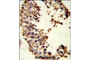 Image no. 3 for anti-Achaete-scute complex protein T5 (AC) (AA 99-127) antibody (ABIN5530383)