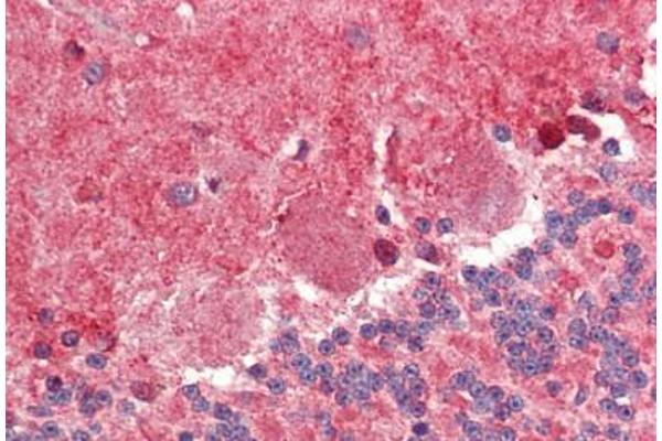 FABP7 antibody  (AA 101-111)