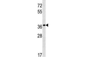 Image no. 1 for anti-Pepsinogen 5, Group I (Pepsinogen A) (PGA5) (AA 354-383) antibody (ABIN3028919)