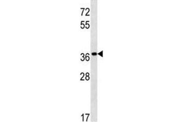 anti-Pepsinogen 5, Group I (Pepsinogen A) (PGA5) (AA 354-383) antibody