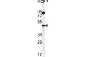 Image no. 1 for anti-Vascular Endothelial Growth Factor C (VEGFC) (AA 27-57), (N-Term) antibody (ABIN955510)