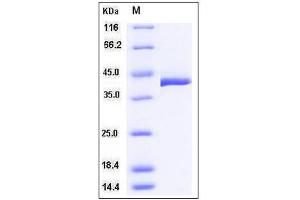 Image no. 1 for Transcobalamin II (TCN2) (AA 1-430) protein (His tag) (ABIN2008170)