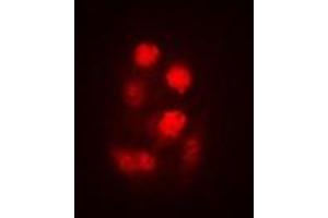 Image no. 1 for anti-tRNA-splicing Endonuclease Subunit SEN2 (TSEN2) (full length) antibody (ABIN6006210)