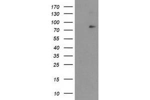 Image no. 2 for anti-Nuclear Factor of kappa Light Polypeptide Gene Enhancer in B-Cells Inhibitor, zeta (NFKBIZ) antibody (ABIN2727234)