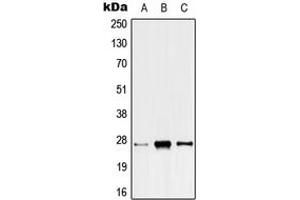 Image no. 1 for anti-Acidic (Leucine-Rich) Nuclear phosphoprotein 32 Family, Member C (ANP32C) (Center) antibody (ABIN2705473)