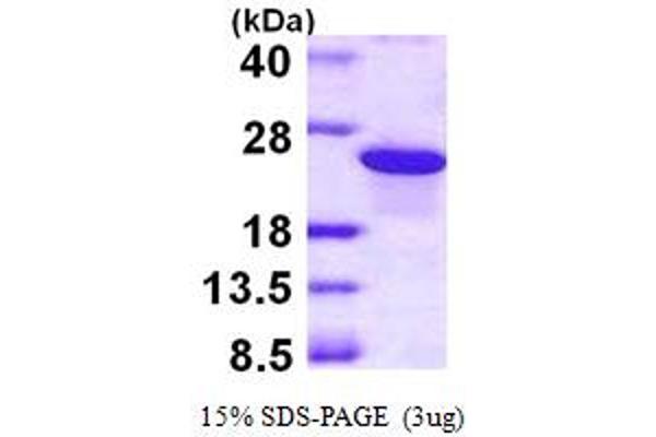 ADP-Ribosylation Factor-Like 5B (ARL5B) (AA 1-179) protein (His tag)