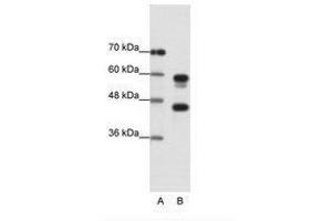 Image no. 1 for anti-Proteasome (Prosome, Macropain) 26S Subunit, ATPase, 5 (PSMC5) (C-Term) antibody (ABIN202447)
