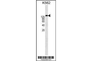 Image no. 1 for anti-ATP-Binding Cassette, Sub-Family B (MDR/TAP), Member 1 (ABCB1) (AA 647-677) antibody (ABIN1538560)