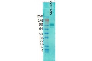 Image no. 2 for anti-Discs, Large Homolog 4 (Drosophila) (DLG4) antibody (Alkaline Phosphatase (AP)) (ABIN2484813)