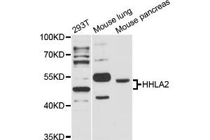 Image no. 1 for anti-HERV-H LTR-Associating 2 (HHLA2) antibody (ABIN6293271)