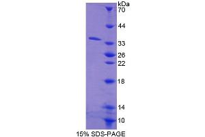 Image no. 1 for Carboxylesterase 1 (CES1) (AA 18-299) protein (His tag) (ABIN6239991)