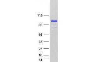 Image no. 1 for SEC14-Like 1 (SEC14L1) (Transcript Variant 4) protein (Myc-DYKDDDDK Tag) (ABIN2731559)