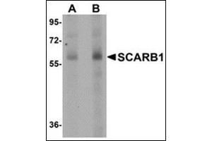 Image no. 2 for anti-Scavenger Receptor Class B, Member 1 (SCARB1) (N-Term) antibody (ABIN500682)