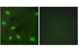 Immunofluorescence analysis of HeLa cells, using GIRK1/KIR3.