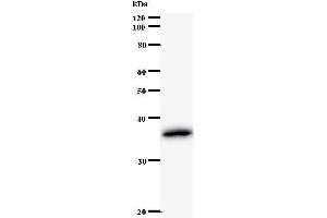 Image no. 1 for anti-Ral GTPase Activating Protein, alpha Subunit 1 (Catalytic) (RALGAPA1) antibody (ABIN931096)