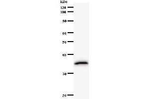 Image no. 1 for anti-Translin-Associated Factor X (TSNAX) antibody (ABIN932466)
