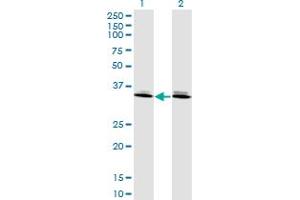 DLX6 anticorps  (AA 71-160)