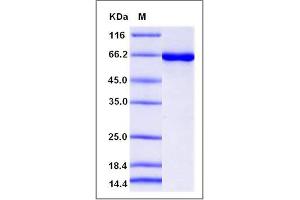Image no. 1 for Casein Kinase 2 alpha 1 (CSNK2A1) (AA 1-391) (Active) protein (GST tag,His tag) (ABIN2008341)