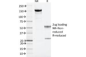 Image no. 3 for anti-ADP-Ribosylation Factor 1 (ARF1) (C-Term) antibody (ABIN6939844)