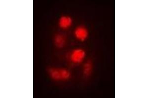 Image no. 1 for anti-tRNA-splicing Endonuclease Subunit SEN2 (TSEN2) antibody (ABIN3197804)