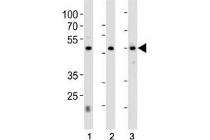 HNF4A antibody western blot analysis in 1) 293, 2) HepG2 cell line and 3) rat liver tissue lysate.