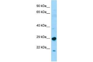 Image no. 1 for anti-Sperm Associated Antigen 7 (SPAG7) (N-Term) antibody (ABIN2790587)