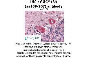 Image no. 1 for anti-Guanylate Cyclase 1, Soluble, beta 3 (GUCY1B3) (AA 189-207) antibody (ABIN2852385)