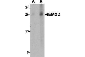 Image no. 1 for anti-Empty Spiracles Homeobox 2 (EMX2) (Middle Region) antibody (ABIN1030923)