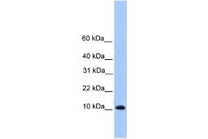 Image no. 1 for anti-Trafficking Protein Particle Complex 6B (TRAPPC6B) antibody (ABIN2459663)